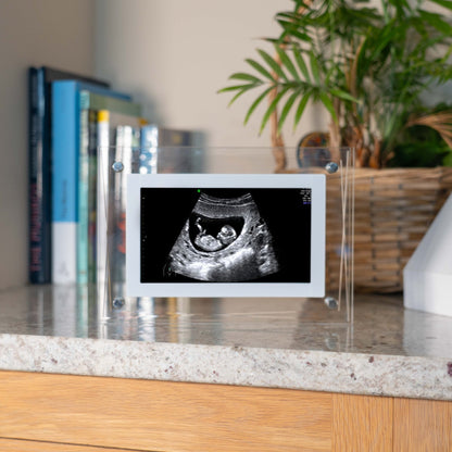 New Baby Digital Photo Frame With Personalised Gift Box